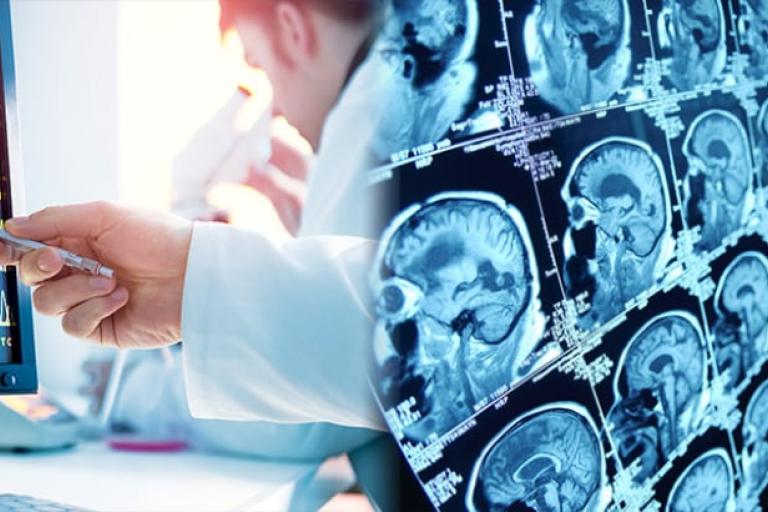 Doctors assessing brain scans
