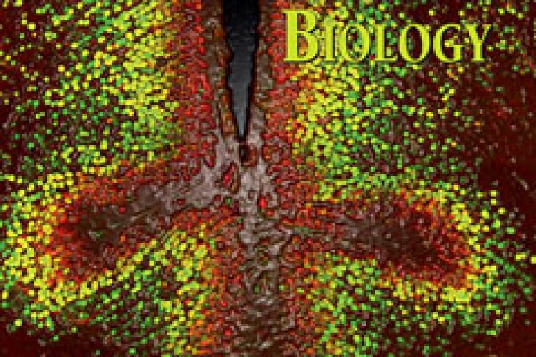 Role of Gpr161 in forebrain development.