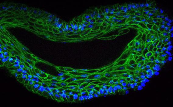 Cancer Cell Lineage Plasticity