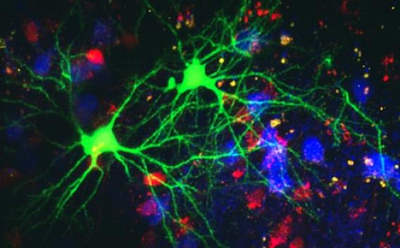 Roberts Lab research