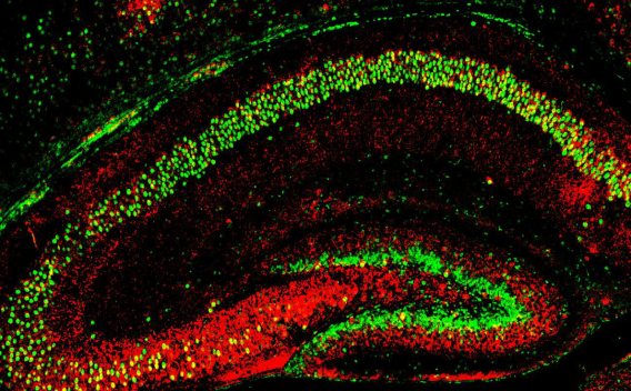 Microscopic view of neurons in vibrant green and red