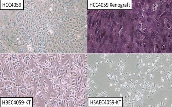 Establishment of New Lung Cell Lines