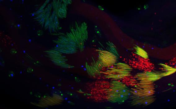 Drosophila male germ cells