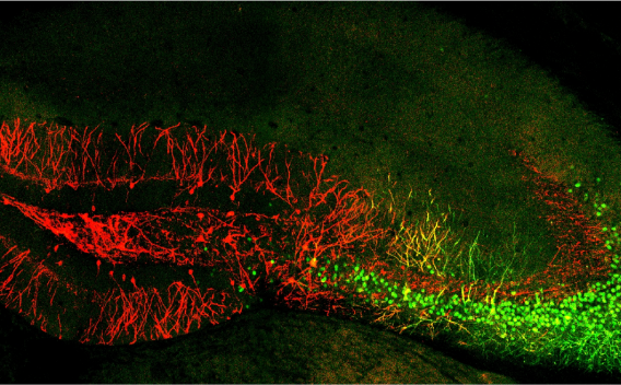 Brain activity