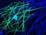 Addressing cellular and molecular mechanisms