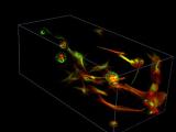RPE Vimentin with Bounding Box