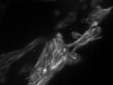 RPE Cells