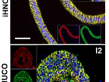 iHNO and iHUCO B-Cat, E-CAD, and DAPI comparison