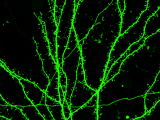 KDM6B regulates dendritic spine density