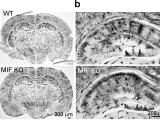 MIF_Golgi