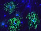 Myelination on dish