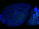 Visualizing newborn oligodendrocytes