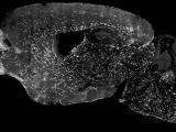 Tracing myelination in space and time