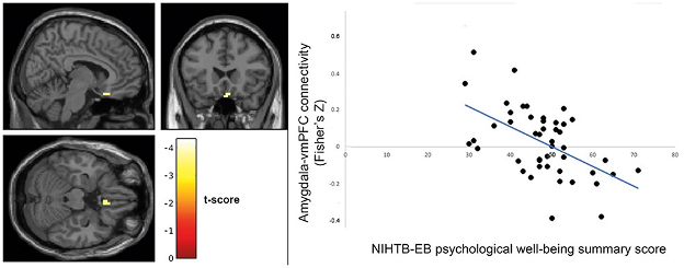NIHTB-EB psychological well-being summary score graphic