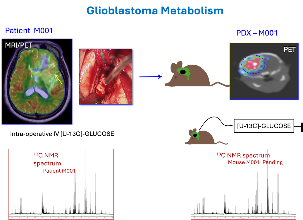 Glioblastoma Metabolism