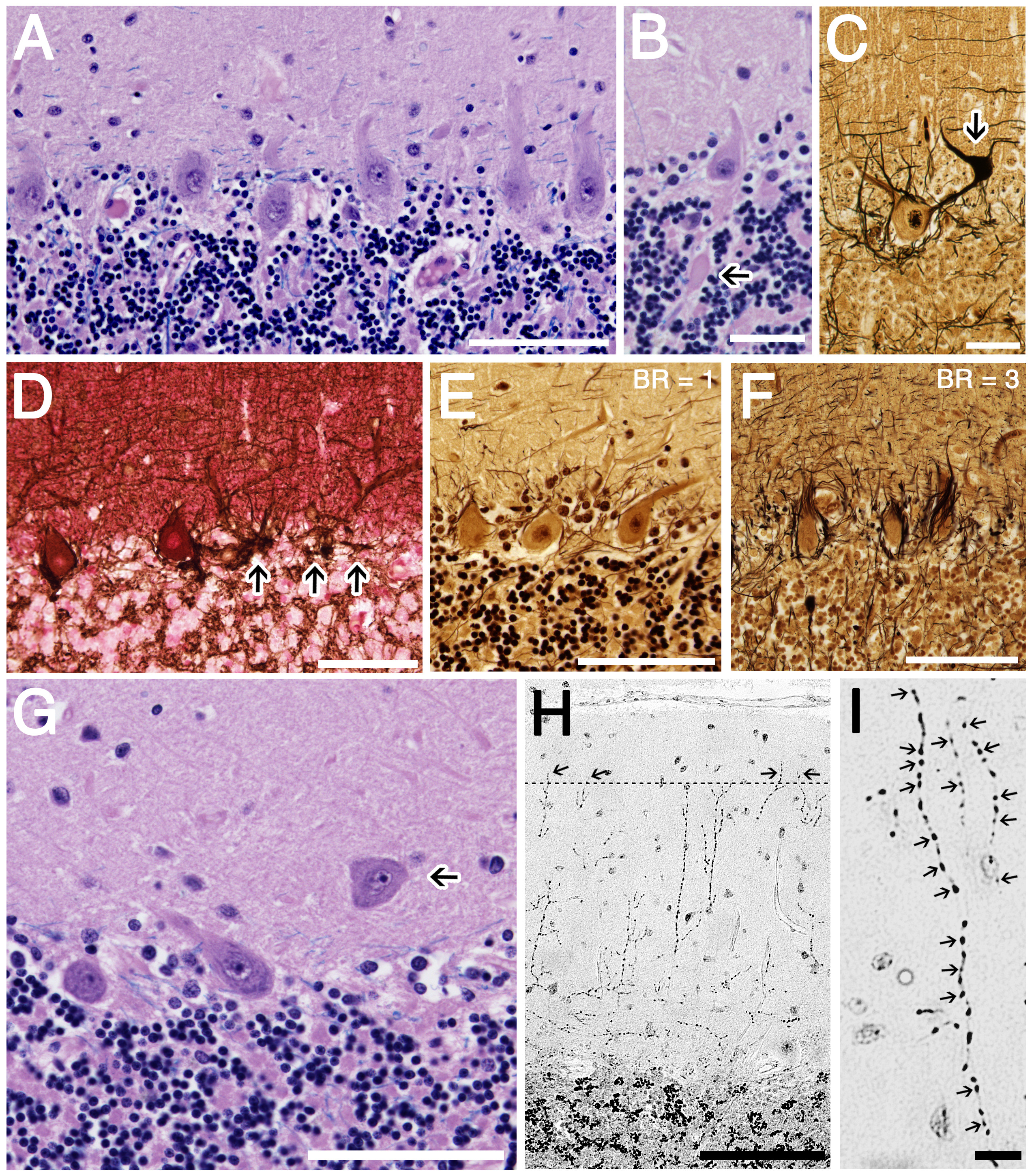 pathophysiological image