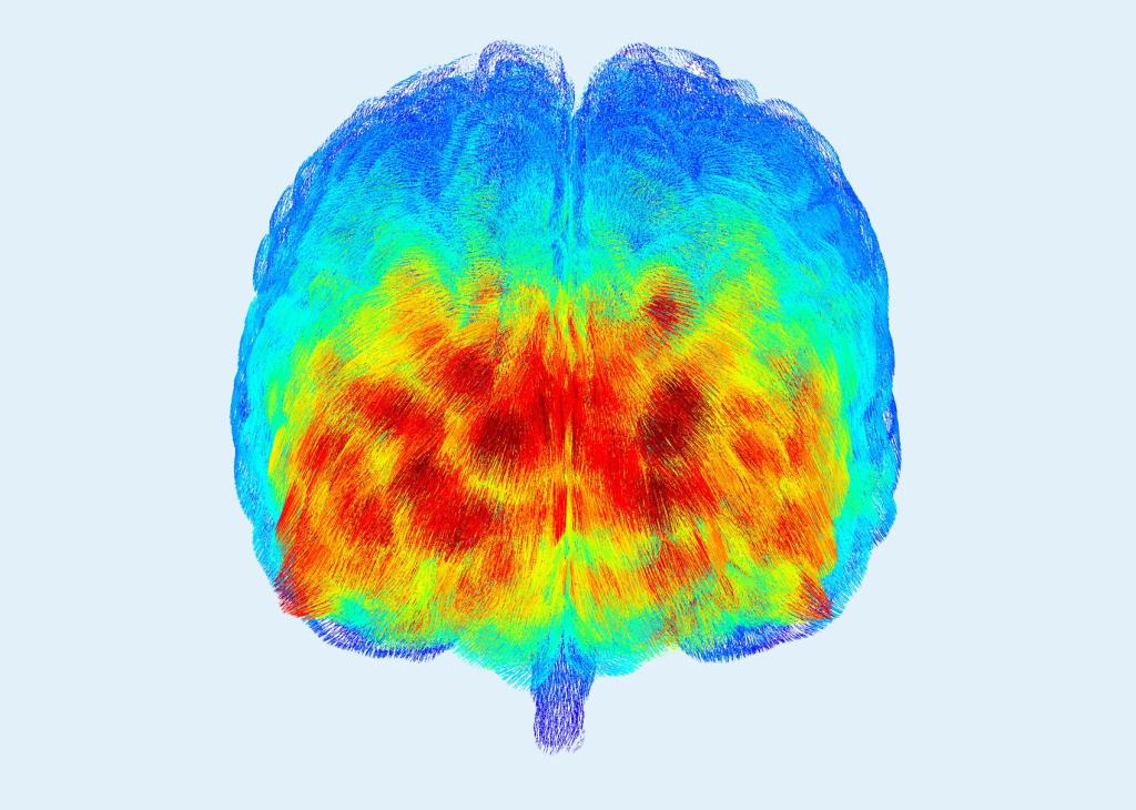 Colorful brain scan image with heatmap-style patterns
