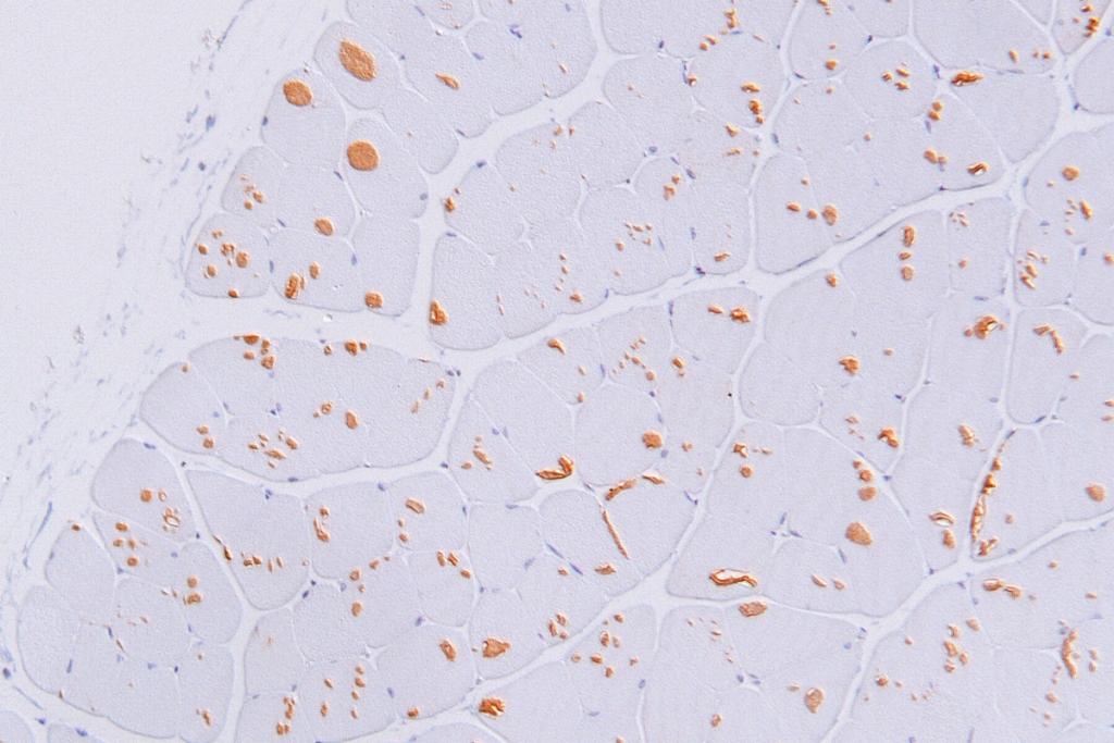 Autophagic inclusions in the muscle of a mouse model as indicated by the light brown spots