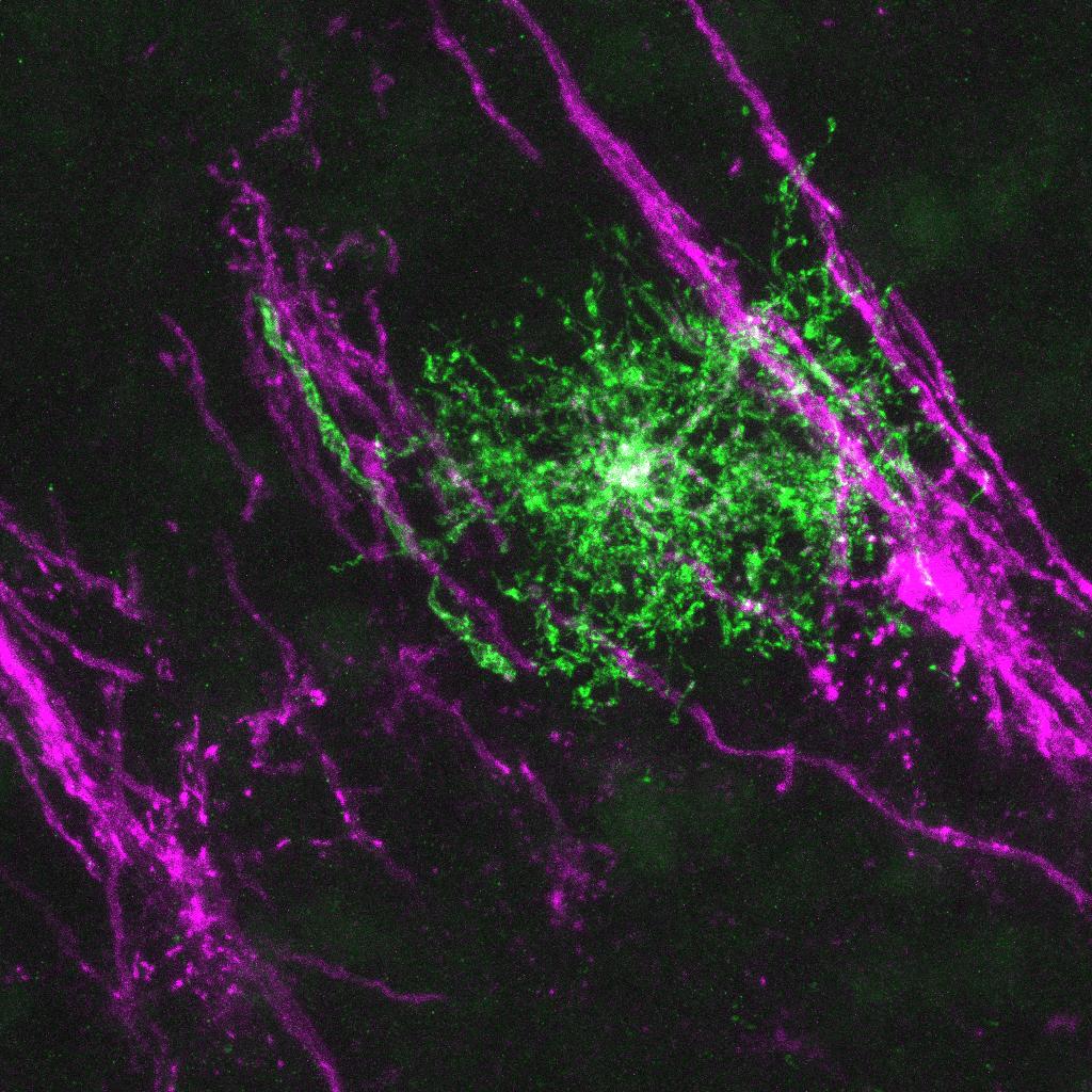 axon ensheathment by premyelinating oligodendrocyte