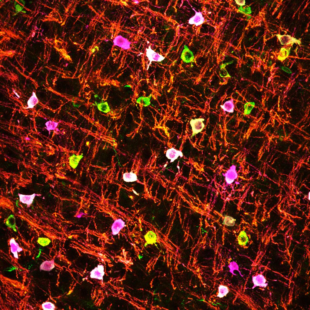  Myelination in action