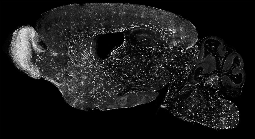 lineage trace newly formed oligodendrocytes