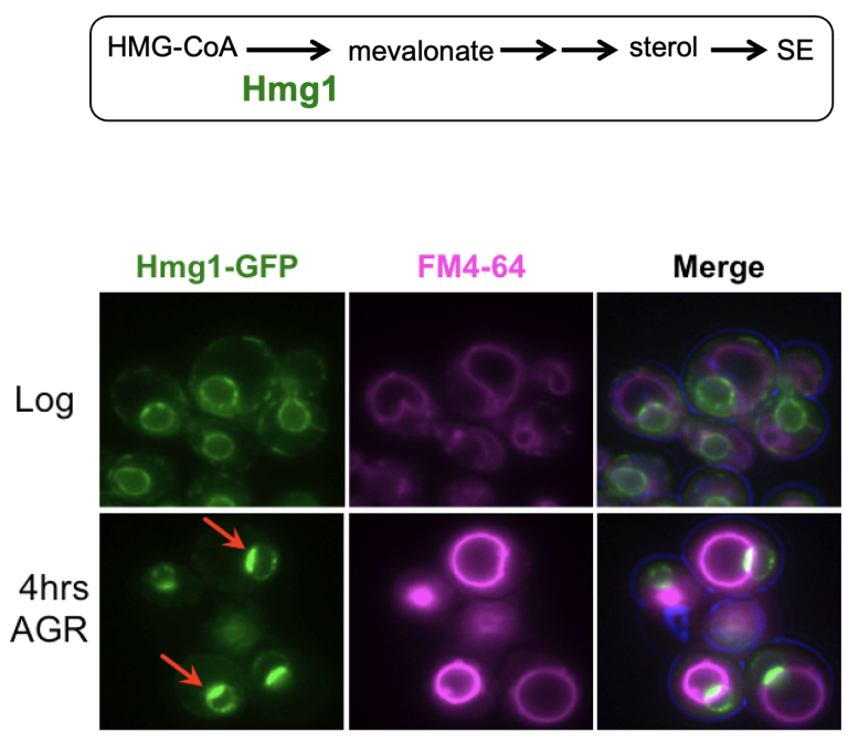 NVJ cells