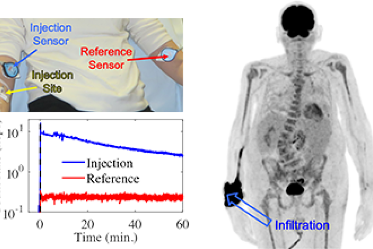Radiotracer Infiltration
