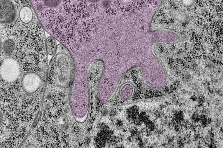 Electron micrograph showing Mechanical stress