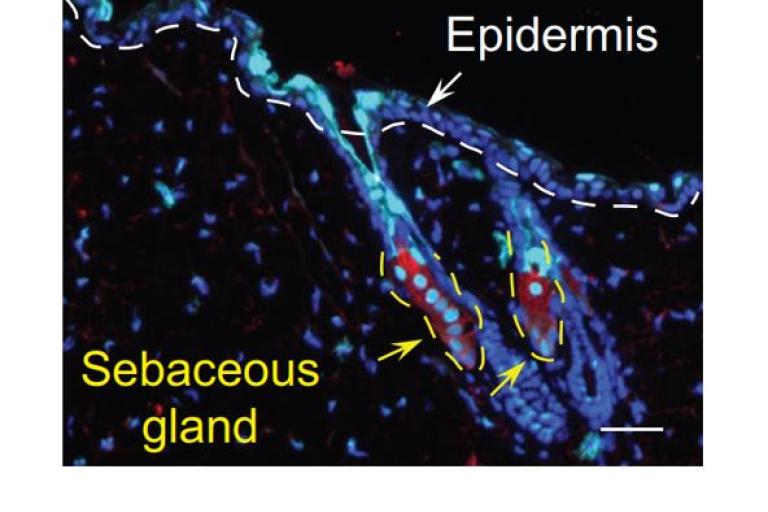 Sebaceous Gland