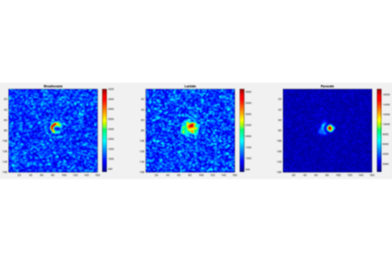 Comparison of three scans, too small to read.