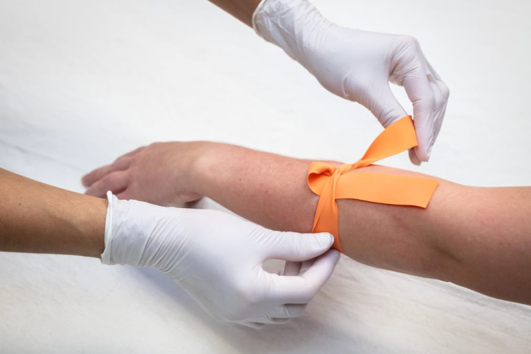 a patient arm tied with orange strap 