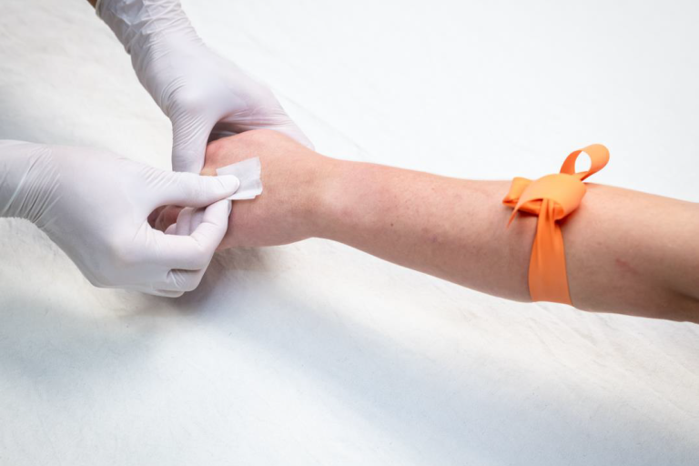 a patient arm tied with orange strap being swab with alcohol