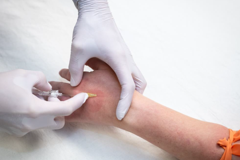 patient arm being prepped for an IV with needle being inserted