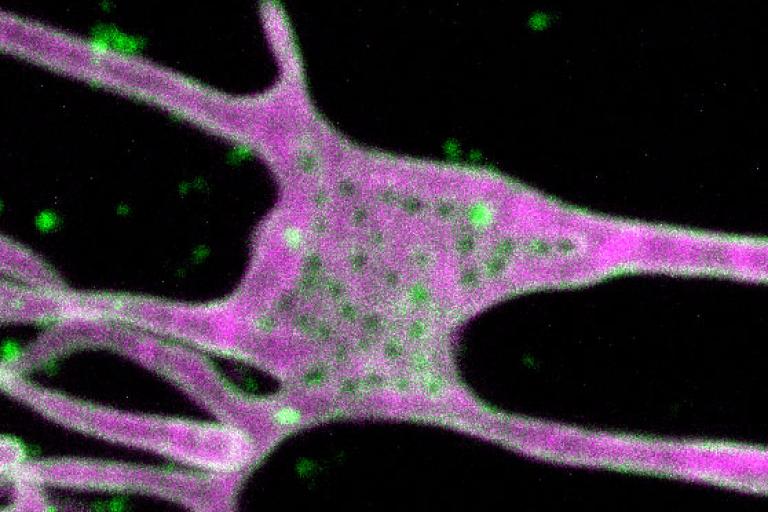 Identification of a new player in mitochondrial fission