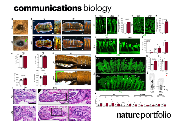 Primary cilia control cellular patterning of Meibomian glands during morphogenesis but not lipid composition