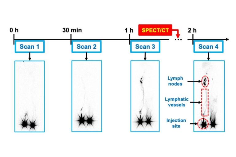 lymphoscintigraphy schematic