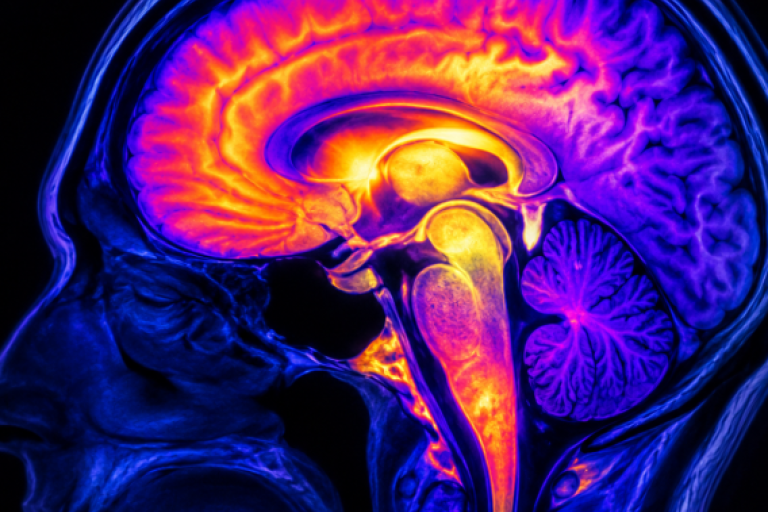 4-CNS and Neuroinflammation Imaging