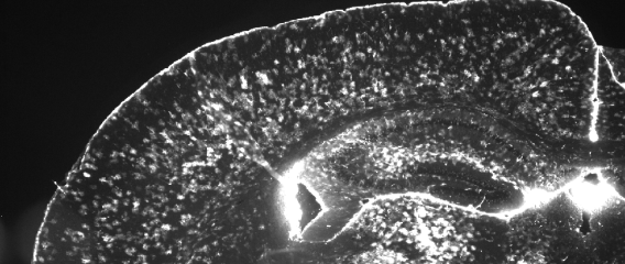 Glial Development