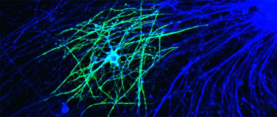 Addressing cellular and molecular mechanisms