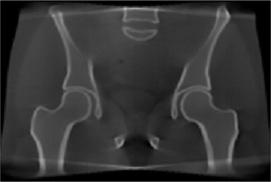 CBCT X-ray with scatter