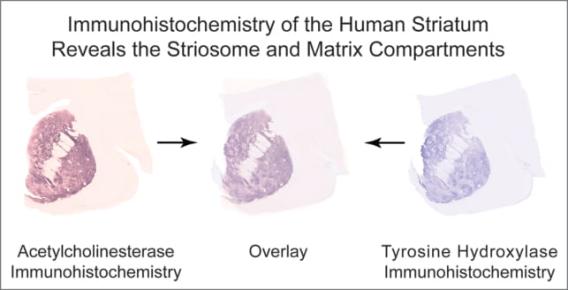 Human Striatum