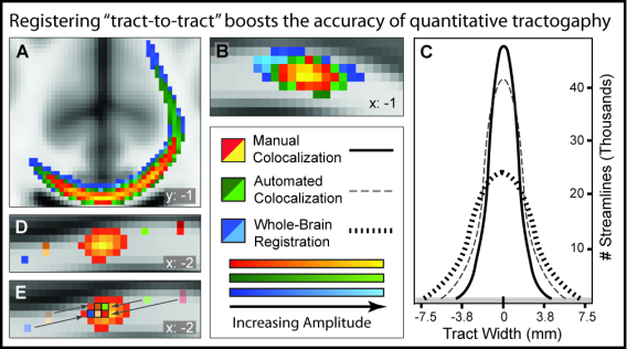 Neuroimaging