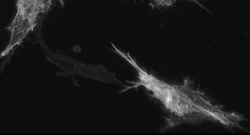 RPE1Htert TractinGFP Cell6 MIP Slice