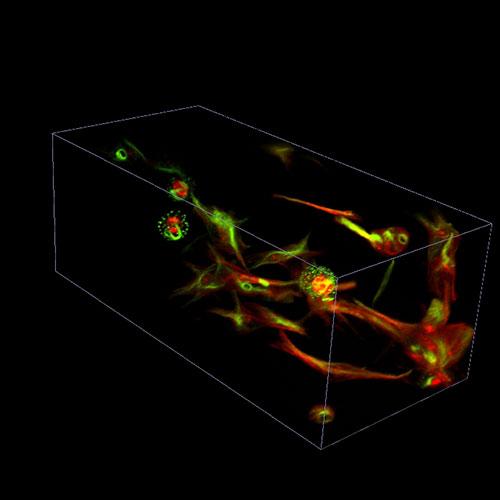 RPE Vimentin with Bounding Box