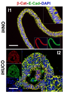 iHNO and iHUCO B-Cat, E-CAD, and DAPI comparison
