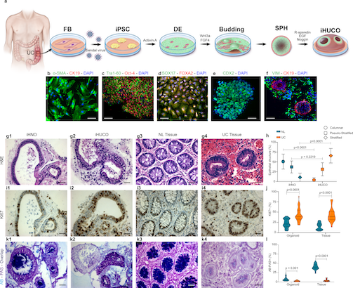 iPSCs to iHUCO model iHUCOs and iHNOs in comparison to Normal and Colitis Tissue via H&E Staining, Ki67 Staining, and Alcian Blue Staininig.