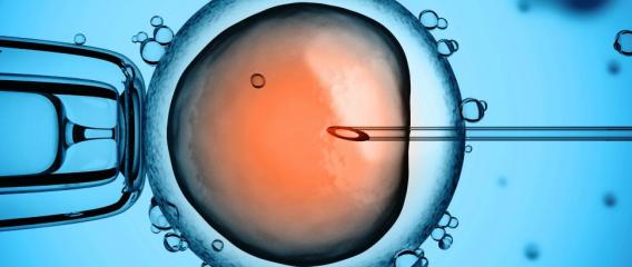 Zygote Genome Editing