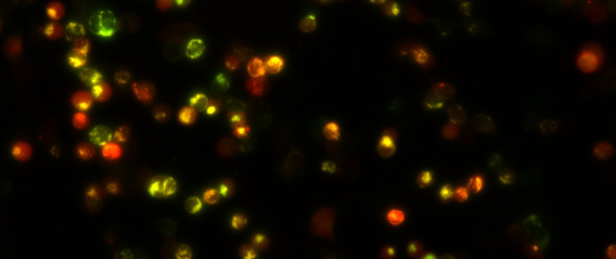 Ion channel and membrane receptor clusters