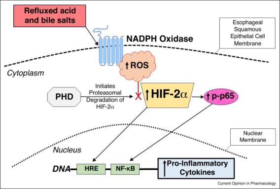 A new paradigm for GERD pathogenesis