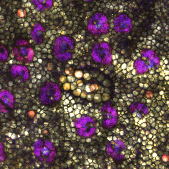 Coherent Raman imaging of skin tissue